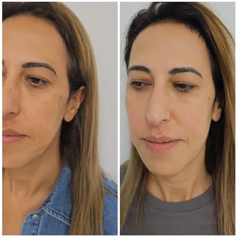 Before and After Hair Treatment