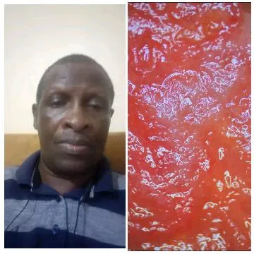 Man and Textured Red Surface