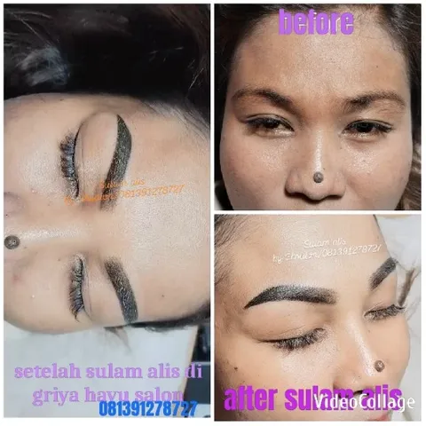 Eyebrow Treatment Before and After