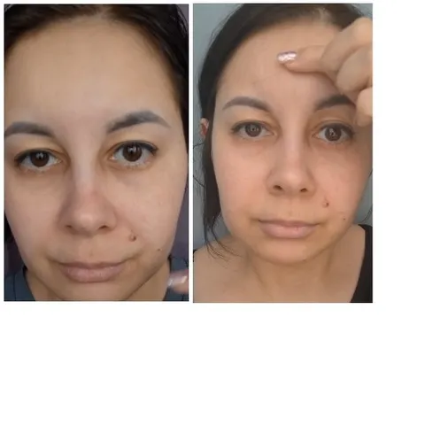 Person Pointing Near Forehead