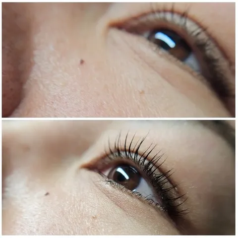 Before and After Eyelash Comparison
