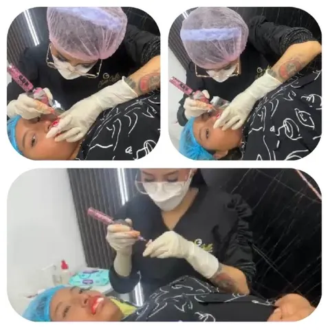 Cosmetic Procedure in a Clinical Setting
