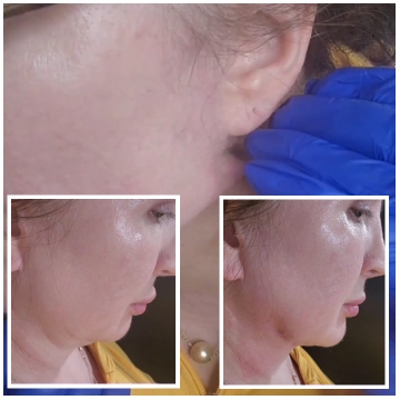 Close-Up of Ear and Side Profile