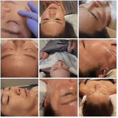 Skincare Treatment Close-Ups