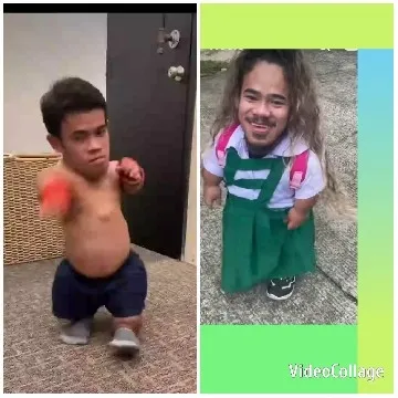 Diverse Individuals with Dwarfism