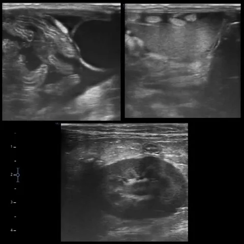 Ultrasound Scans of Internal Structures