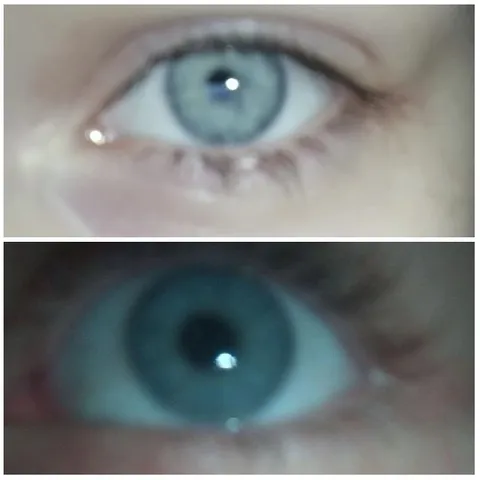 Close-Up Views of Human Eyes