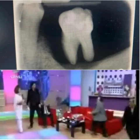 Dental X-Ray and Talk Show Set