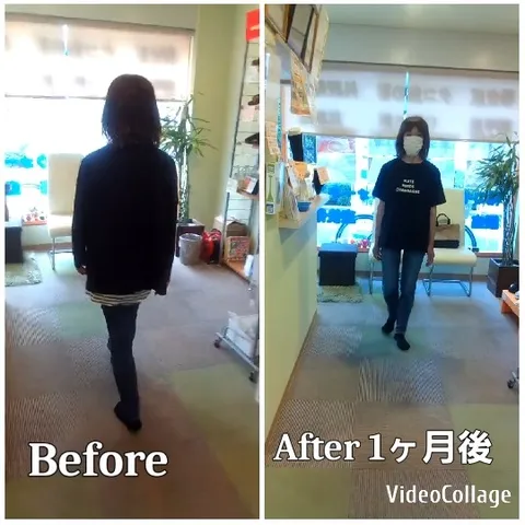 Before and After Walking Comparison