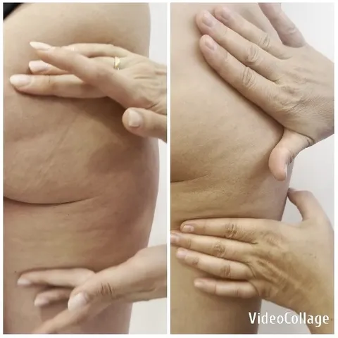 Skin Texture Demonstration