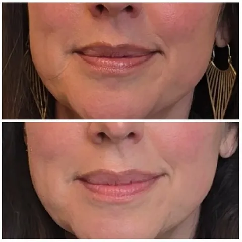 Subtle Smile Variations on Display