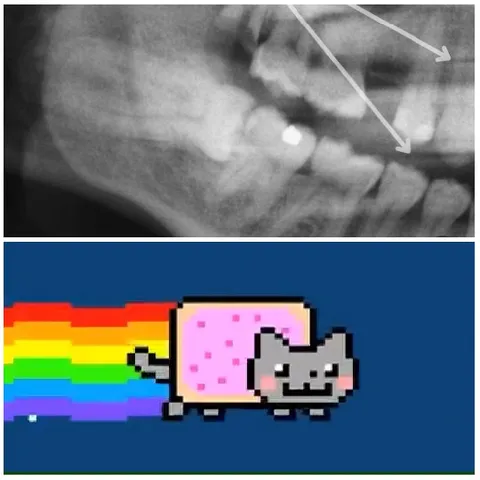 Dental X-Ray and Nyan Cat