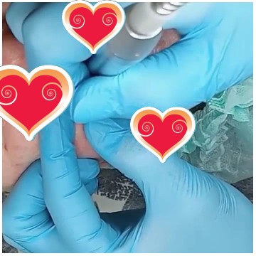 Hands in Blue Gloves at Work
