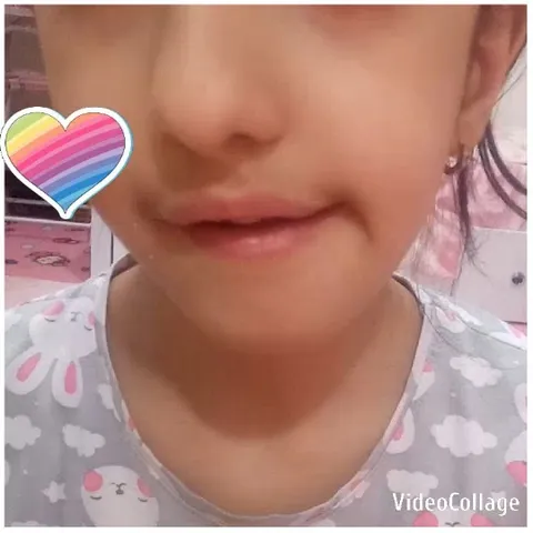 Child's Face with Heart Graphic