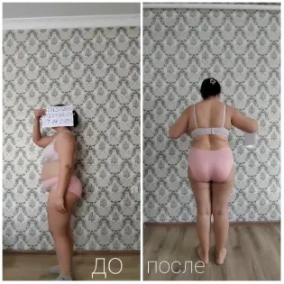 Before and After Side Views