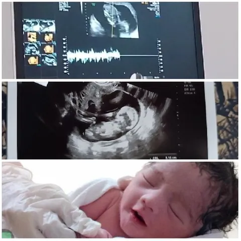 Ultrasound Images and Newborn Baby