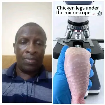 Chicken Leg Under the Microscope