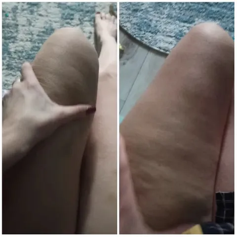 Thigh Comparison and Detail