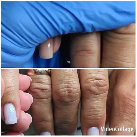 Nail Comparison with Close-Up View