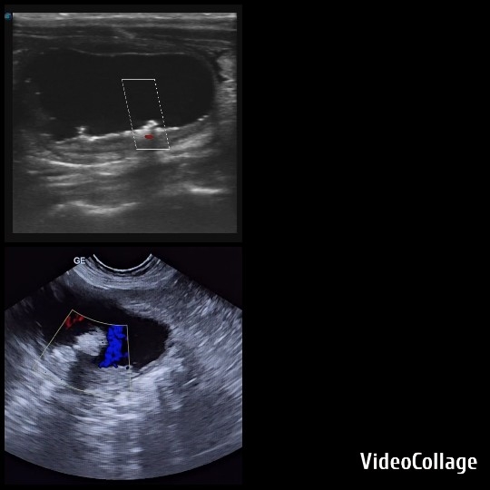 Ultrasound Scans Showing Development