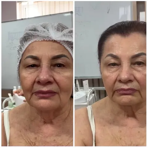 Before and After Hair Net