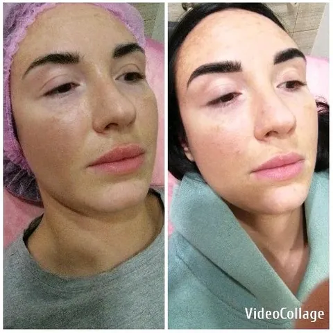 Comparison of Woman's Facial Appearance
