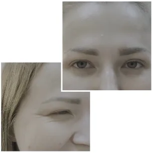 Close-Up of Smiling Eyes and Forehead