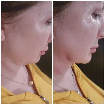 Profile Comparison of Woman's Face