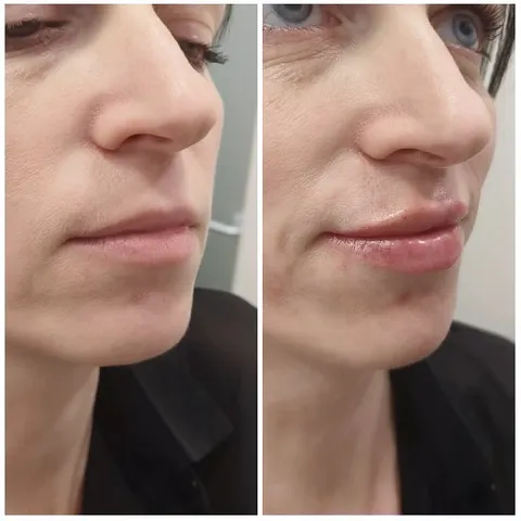 Face Comparison with Enhanced Lips