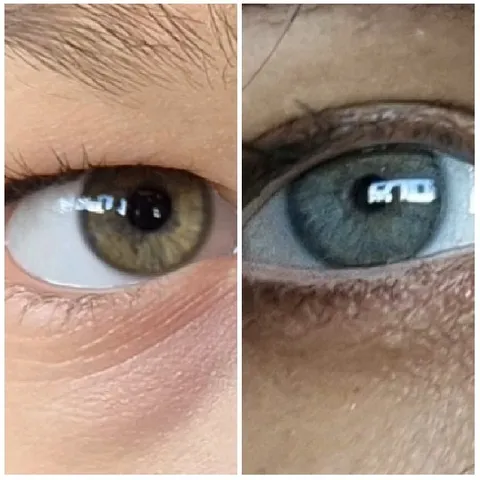 Close-Up of Two Different Eyes