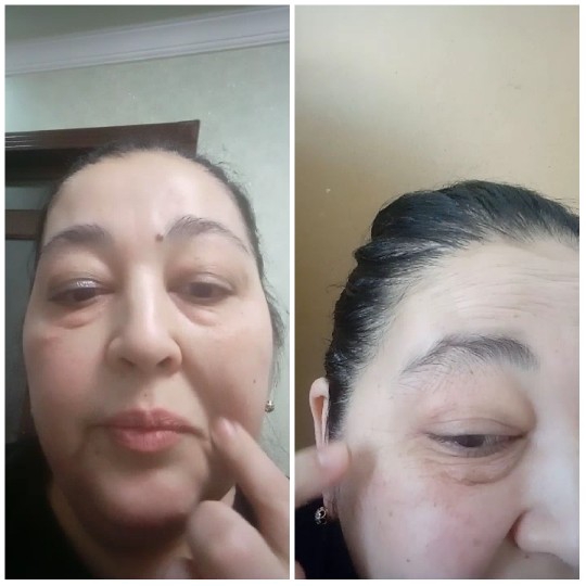 Woman Touching Her Face