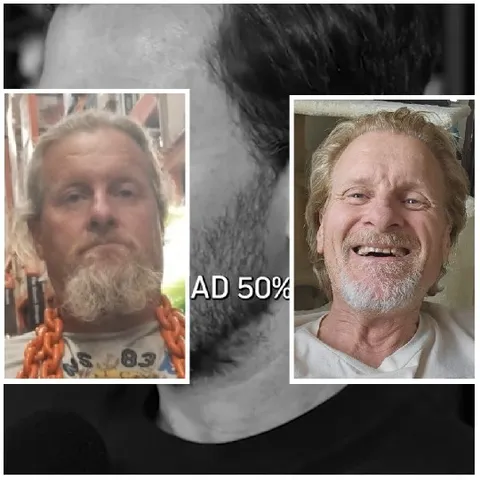 Man with Beard in Two Settings