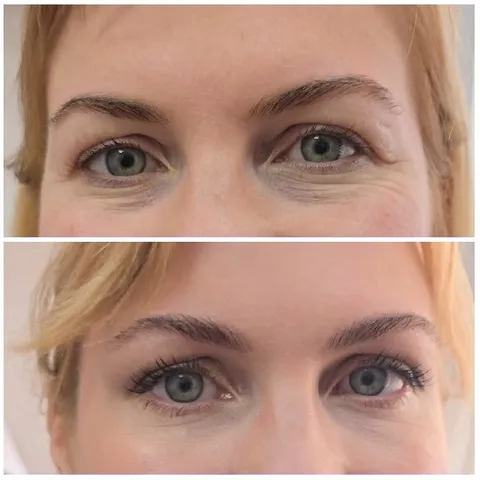 Eyebrow Transformation Before and After