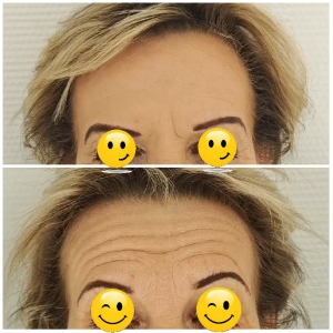 Skin Comparison: Smooth vs Wrinkled