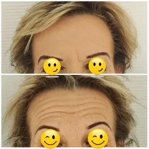 Skin Comparison: Smooth vs Wrinkled