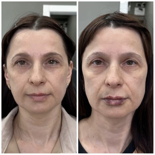 Before and After Makeup Transformation