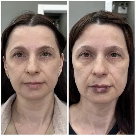 Before and After Makeup Transformation