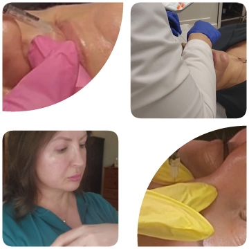 Close-Ups of Cosmetic Procedures