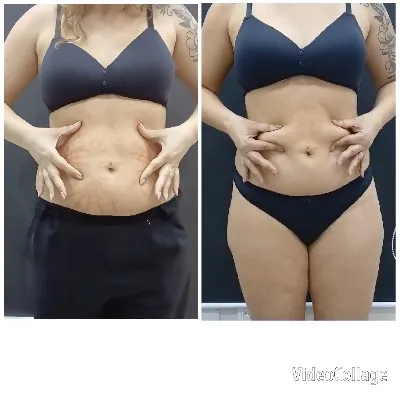 Physiques In Dark Undergarments