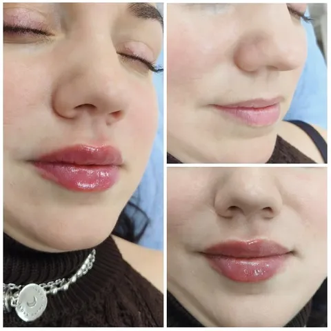 Close-Up of Glossy Lips