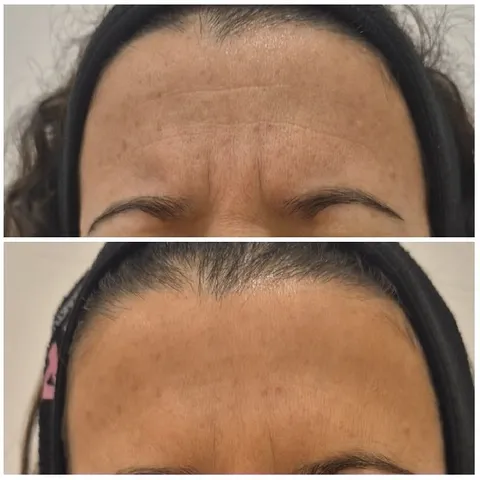 Before and After Skincare Comparison