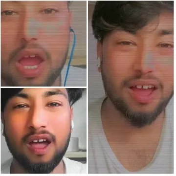 Man with Beard in Various Poses