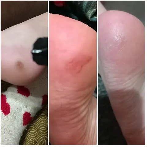 Foot Health Comparison