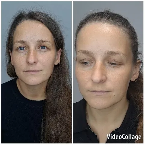 Two Portraits of the Same Woman