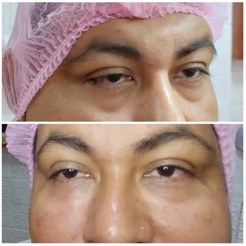 Close-Up Before and After Face Comparison