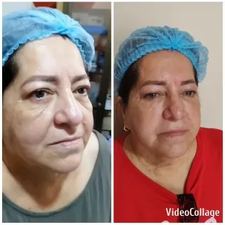 Close-Ups of Woman with Hair Cap