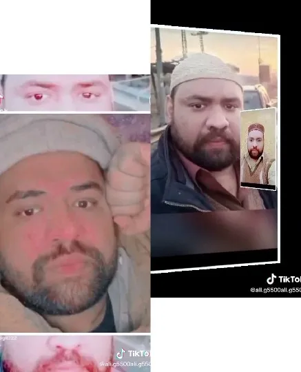 Man’s Face and Outdoor Image