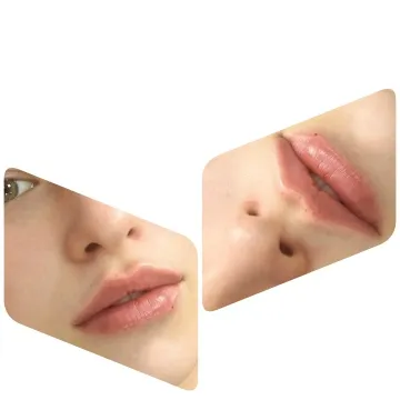 Close-Up of Lips and Face