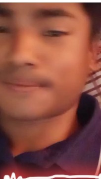Person with Blurred Face in Striped Background