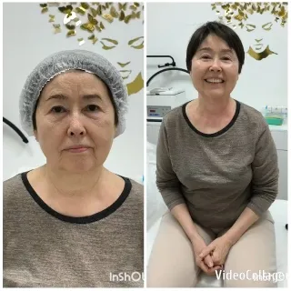 Older Woman's Expressions in Two States